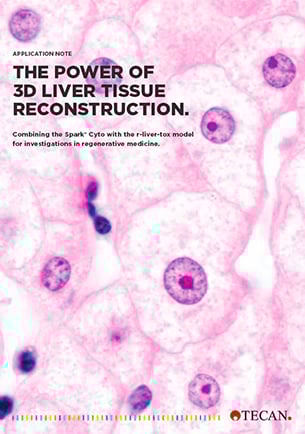The power of 3D liver tissue reconstruction