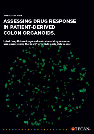 Assessing drug response in patient-derived colon organoids